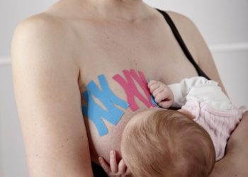 Kinesiotaping w profilaktyce nawałów mlecznych