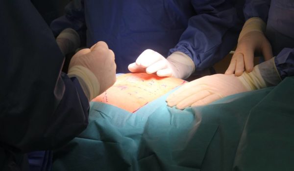 Czy przed i po zabiegu operacyjnym w ginekologii potrzebna jest rehabilitacja?
