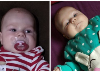 Mała Sandra pilnie potrzebuje pomocy!